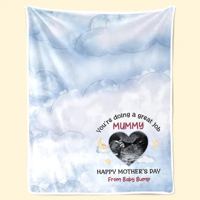 Custom Ultrasound Photo Mother's Day Gifts for Mommy - Personalized Blanket